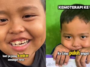 Perjuangan Devin Lawan Kanker Darah di Usia 7 Tahun, Butuh 108 Kali Kemoterapi