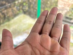 Hujan Es Seukuran Kelereng Landa Lereng Merapi Magelang