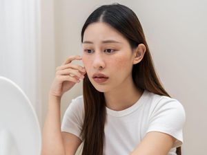 Wajah Mulai Berubah? Bisa Jadi Tanda-tanda Tubuh Kekurangan Kolagen