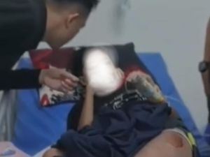 Video: Ini Hasil Autopsi Bocah Sukabumi yang Diduga Tewas Dianiaya Ibu Tiri
