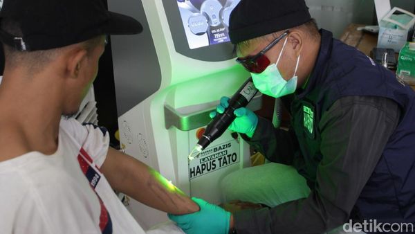 Antusias Warga Ikuti Program Hapus Tato Gratis di Masjid Sunda Kelapa