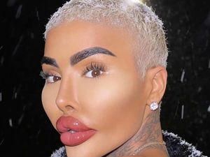 Influencer Populer Dijuluki Lip King Meninggal Dunia setelah Operasi Plastik