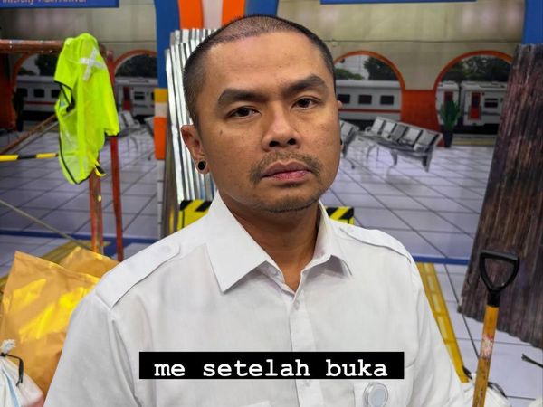 Alasan Wendi Cagur Transplantasi Rambut: Bukan Gaya Tapi Faktor Kesehatan!