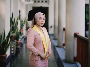 Lulus S1 Kedokteran Gigi UGM di Usia 20 Tahun, Apa Tips Tiara?