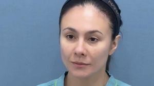 Potret Wulan Guritno Jalani Oplas di Korea Agar Kulit Lebih Kencang