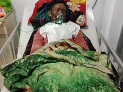 Polres Sumbawa Selidiki Kasus Anak Tewas Dibakar Ibu meski Tak Ada Laporan