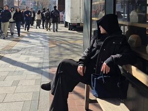 Wulan Guritno Habis Operasi, Pose Muka Diitutup Bukan Ikut Tren atau ala Gen Z