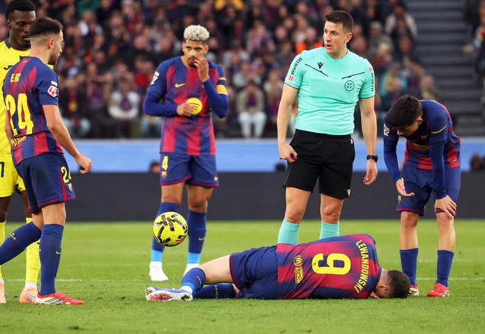 Robert Lewandowski cedera saat Barcelona mengalahkan Vilarreal 4-1 di lanjutan LaLiga, akhir pekan lalu.