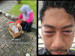 Pakar UGM Ingatkan Efek Cespleng Jamu, Bisa Jadi Mengandung Bahan Kimia Obat