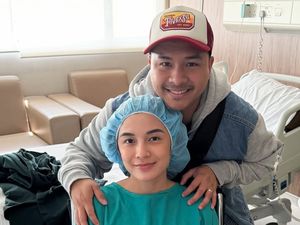 Potret Chelsea Olivia Usai 4 Kali Operasi Rahim, Tetap Glowing Tanpa Makeup