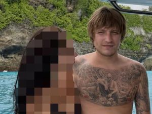 Polisi Kirim Sampel Potongan Tubuh WN Ukraina ke Jakarta