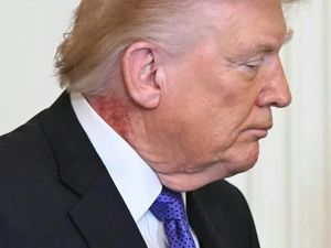 Trump Muncul di Gedung Putih dengan Ruam Merah di Leher, Kenapa?