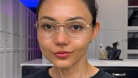 Cerita Rina Nose Operasi Hidung Pakai Tulang Iga, Bikin Wajah Jadi 'Ningrat'