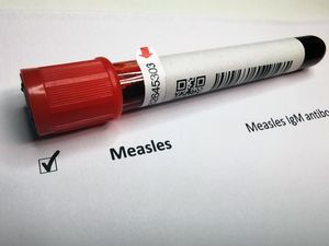 Stop Sentuh-sentuh Bayi saat Lebaran! Ini Wanti-wanti Kemenkes soal Penularan Campak