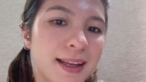 Ini Bagian Wajah Shalom Razade yang Bermasalah Sebelum Dioperasi