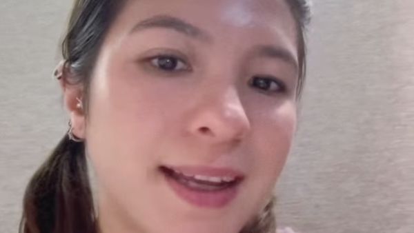 Ini Bagian Wajah Shalom Razade yang Bermasalah Sebelum Dioperasi