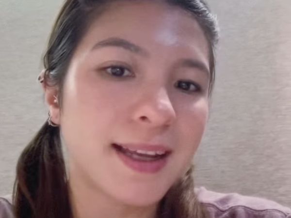 Ini Bagian Wajah Shalom Razade yang Bermasalah Sebelum Dioperasi