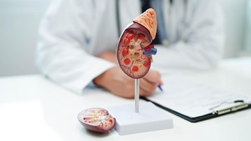 Kenali Gagal Ginjal Kronis, Si 'Silent Disease' yang Sulit Terdeteksi Dini