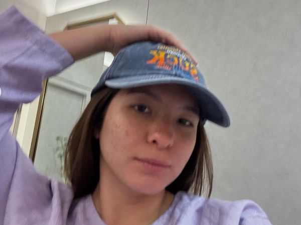 Detik-detik Shalom Razade Operasi Plastik, Hidung Dicoret-coret Dokter