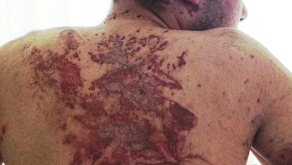 Ngeri! Deretan Gambar Medis Ini Bikin Merinding