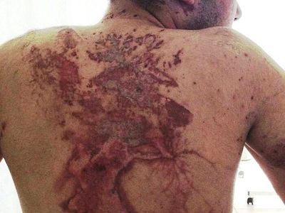 Ngeri! Deretan Gambar Medis Ini Bikin Merinding