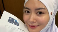 Keren! Ayana Moon Ditawari S2 di Universitas Oxford