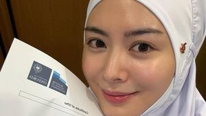 Keren! Ayana Moon Ditawari S2 di Universitas Oxford