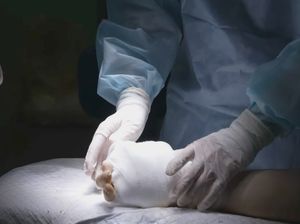 Video Rusia Sukses Lakukan Cangkok Tangan untuk Pertama Kalinya!