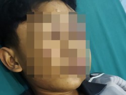 Santri di Kubu Raya Diduga Alami Kekerasan, Wajah Lebam dan Belum Sadar