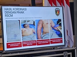 Video: Komisi III DPR Minta Kemenkes Tanggung Biaya Pengobatan Andrie Yunus