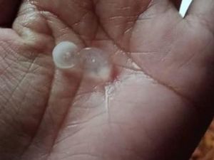 Fenomena Hujan Es Sebesar Kelereng Guyur Mattirowalie Bulukumba 30 Menit