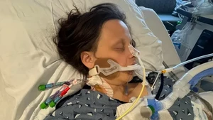 Ngeri! Usai Makan Ikan Fermentasi, Wanita Ini Nyaris Tewas