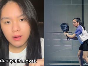 Viral Wanita Alami Kista Bahu Diduga gegara Main Padel 6 Jam Sehari