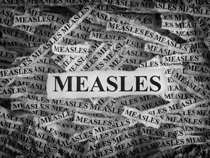 Kaitkan Campak dengan Provokasi Antivaksin, Kemenkes Laporkan Konten Penebar Hoax!