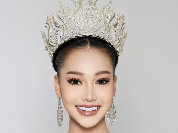 Senyum Manis Kamolwan Chanago, Calon Ratu Kecantikan yang Veneer Giginya Lepas