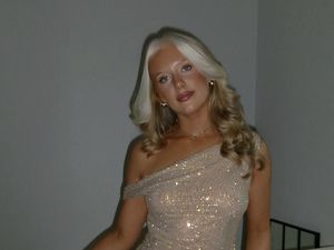 Rambut Putih Bukan karena Usia, Ini Kisah Wanita dengan Kondisi Genetik Langka