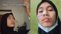 Viral Wanita Tasikmalaya Hanya Bisa Makan Lewat Selang, Idap Kondisi Langka Ini
