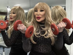 Transformasi Wajah Artis Meksiko Viral, Imbas Suntikan Berbahaya