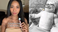 Kronologi Wanita Bali Transplantasi Kulit usai Hampir Seluruh Tubuh Kena Luka Bakar