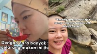 Kisah Wanita Cianjur Baru Ketahuan Idap Kanker setelah MCU, Ini Awal Mulanya