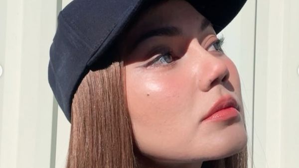 Potret Rina Nose Liburan ke Melbourne Bareng Suami, Memukau Usai Oplas Hidung