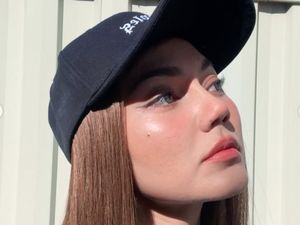 Potret Rina Nose Liburan ke Melbourne Bareng Suami, Memukau Usai Oplas Hidung