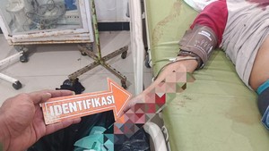 Tukang Ojek Ditemukan Penuh Luka di Paniai Diduga Dibacok OTK