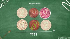 Tes Mata dan Kecerdasan, Belum Ada yang Bisa Jawab Benar Semua