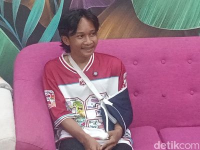 Penampakan Fajar Sadboy Usai Kecelakaan Motor