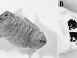 Batuk Parah Tak Sembuh, Ternyata Ada Larva Lalat Bersarang di Hidung Wanita Ini