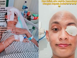 Viral Pria Medan Angkat Bola Mata gegara Kena Kanker, Inikah Penyebabnya?