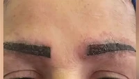 Berawal Dari Tato Alis, Wanita Ini Berakhir Alami Penyakit Serius