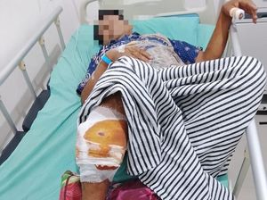 Petani di OKU Diserang Beruang Saat Sedang Sadap Karet