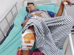 Petani di OKU Diserang Beruang Saat Sedang Sadap Karet